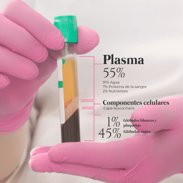 plasma-rico-en-plaquetas-beauty-technique